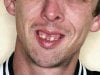 nm_bad_teeth_090212_mn-300x225.jpg