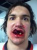 mitch-callahan-puck-face.jpg