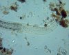 mystery-nematode400x.jpg