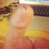 penis_thumb2.jpg