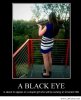 A-black-eye.jpg